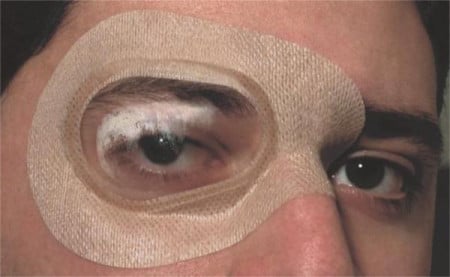 Ortolux® Eye Bubble Moisture Chamber - Large - Laadlee