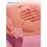 Frida Mom C-Section Silicone Scar Patches - Pack of 6