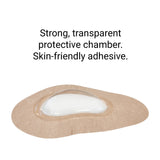 Ortolux® Eye Bubble Moisture Chamber - Large - Laadlee